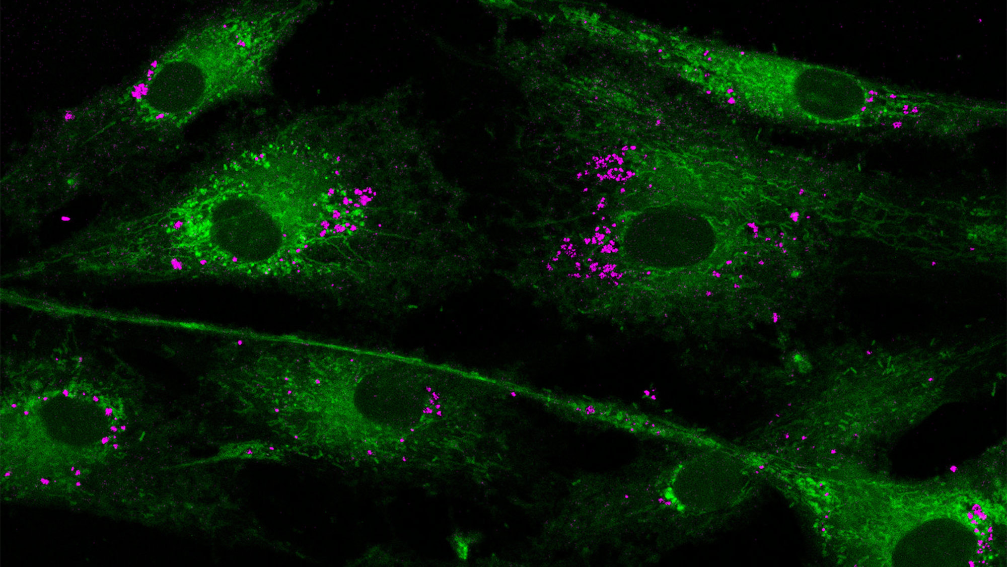 Nanoparticles interacting with the mitochondria. | Image: Courtesy of Akhilesh Gaharwar.